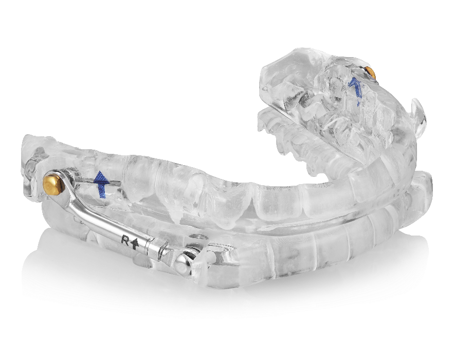 ProSomnus PH Sleep and Snore Device